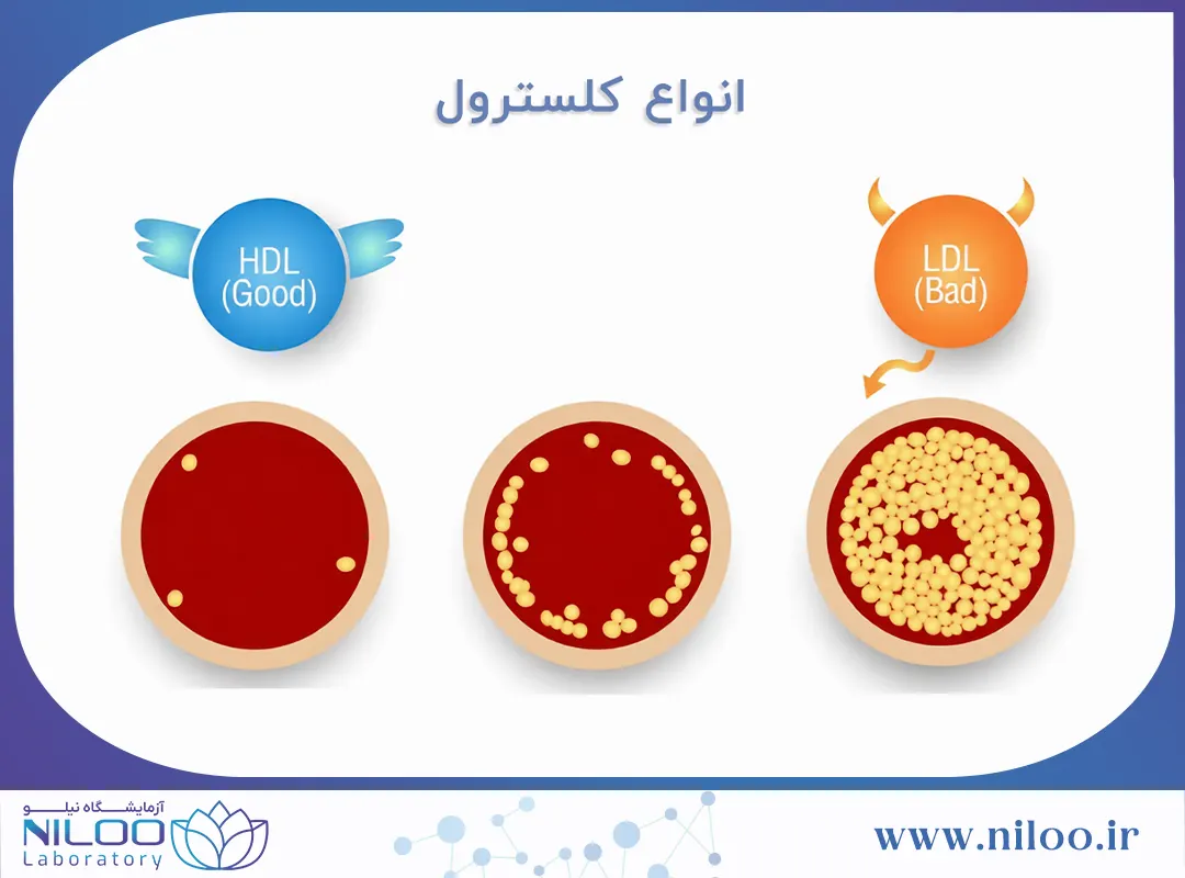 انواع کلسترول خون